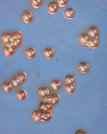 Microscopic view of organic particles in blue liquid
